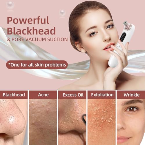 5-Speed ??Blackhead Remover Vacuum, Wireless Charging Nose Pore Extractor with 4 Removable Heads,Facial Vacuum Pore Cleaner,30-Second Keratin Softening, Hypoallergenic Deep Cleansing