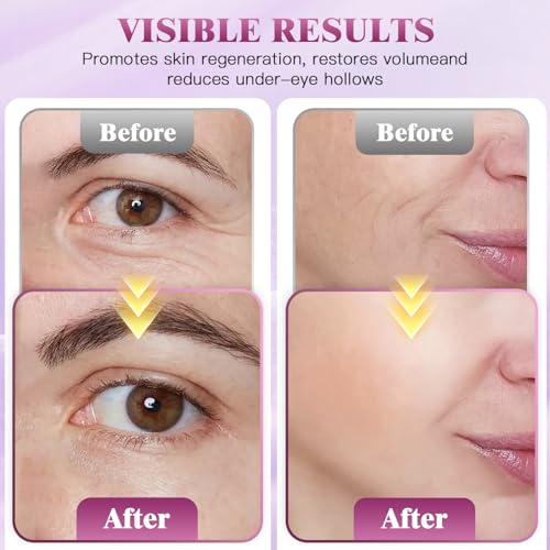 Auriela Calcium Volume Multi Balm,Calcium Multi Balm Stick,Anti Wrinkle,Anti-Aging,Long-Lasting Hydrating, Firming Skin, for Face, Eyes, Lips & Neck(2PCS)