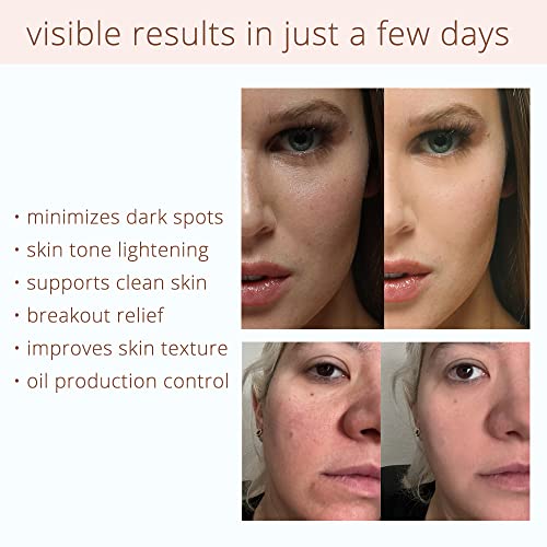 Coffeeface Anti-Aging Moisture Pads with Exfoliation and Hydration | 3-in-1 Textured Skin Treatment | Hypoallergenic for All Skin Types | 16 Count |
