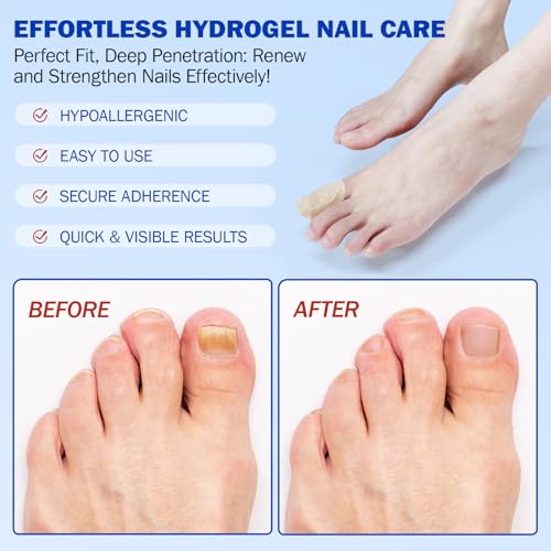 Fungal Nail Patches 42 PCS, Toenail Treatment Extra Strength 8-Hour Overnight Nail Fast Acting Repair Effortless Hydrogel Nail Care and Repair for Damaged Nails Overnight Renewal for Men and Women