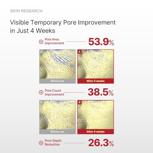 Repair Lifting Shot 300 ? Korean Skin Booster Serum with Micro EC-Spicule ? Clinically Tested for Pore Care, Wrinkle Reduction & Skin Elasticity (50ml)