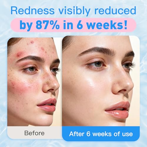 Face Towels Skin Club,1 Pack 100 Ct makeup remover wipes, 10"¡¿12" Disposable eyelid wipes XL, Ultra Soft Makeup Remover Dry Wipes, Facial Towel