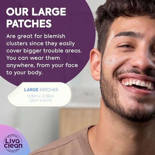 60CT Large Pimple Patches - Hydrocolloid Acne Patches with Salicylic Acid, Tea Tree & Calendula Oil - Full Face Pimple Patch - Blemish Patch for Chin, Nose, Forehead, Body - Hydrocolloid Bandages XL