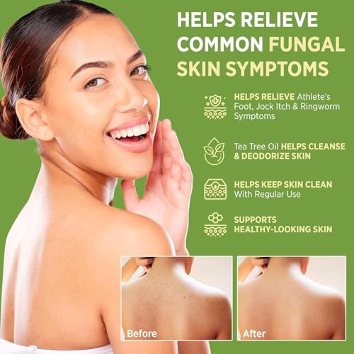 Roycederm Antifungal Bar Soap - Tea tree Oil Soap - Athlete¡¯s Foot Treatment for Jock Itch & Ringworm - Medicated Antifungal Soap with Clotrimazole 1% - Tea Tree Oil Scent, 3 Pack