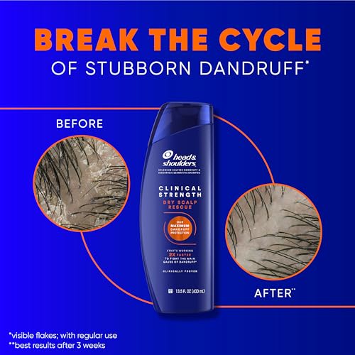 Head & Shoulders Anti-Dandruff Shampoo,Clinical Strength Dry Scalp Rescue,1% Selenium Sulfide,Seborrheic Dermatitis Relief,Dry Scalp,13.5 fl oz + Conditioner,9.1oz,(Pack of 4)