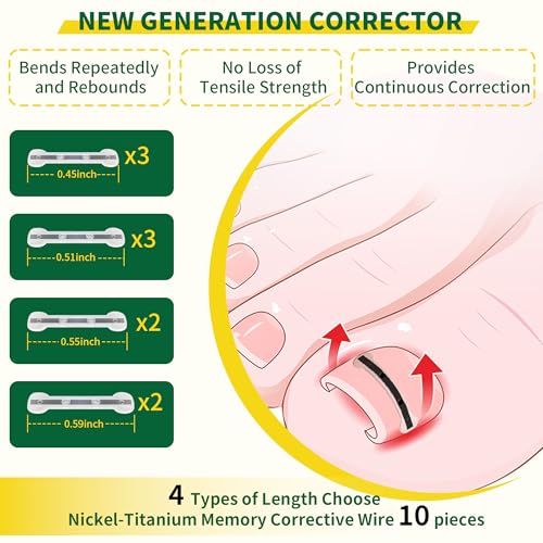 Small Size-Titanium Alloy Ingrown Toenail Treatment & Removal Kit for Quick Relief, Ingrown Toenail Removal Kit£¬ Professional Ingrown Toenail Corrector, Ingrown Toenail Tools for Quick Relief, 10 Pcs