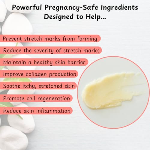 Stretchies and Stripes Stretch Mark Balm | Intense Relief | Pregnancy Safe