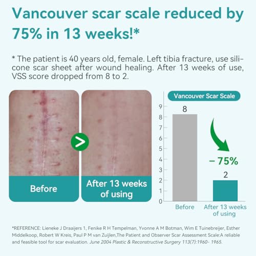 Dimora Medical Grade Silicone Scar Sheets - Ultra Soft Silicone Scar Tape (1.6¡±x120" Roll), Waterproof Scar Treatment for Surgical Scars, C Section, Tummy Tuck, Keloid Treatment