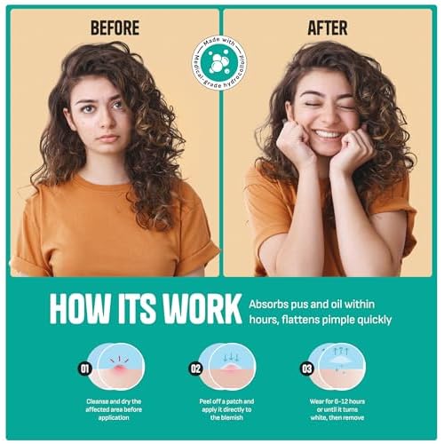Pimple Patches for Face ? Day & Night Acne Patches for Fast Healing, Skin Clarity ? Invisible Hydrocolloid Patches, Waterproof Spot Treatment ? All Skin Types Zit Patches of 60/120/180