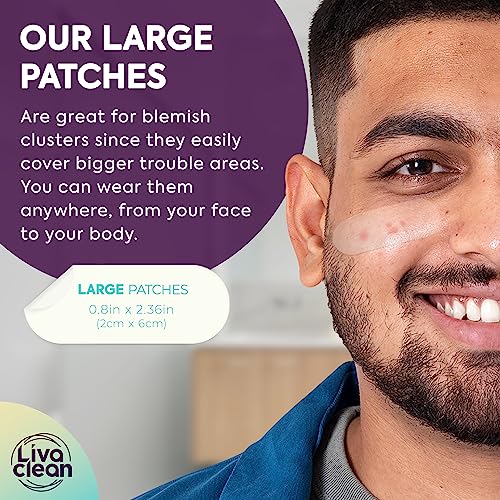 50CT Large Pimple Patches for Face Nose Spots Pores - XL Blemish Patches Acne Patch for Chin Forehead Body - Hydrocolloid Bandages for Acne - Big Clear Zit Stickers Large Hydrocolloid Patch Strips