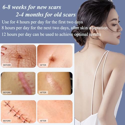 Medical Grade Silicone Scar Sheets 1.6"x 157" Roll-4M Keloid Scars Removal C-Section Scar Strip Painless Treatment Resuable Tummy Tuck Tape Professional for Surgical Incision,Acne,Burn Scar