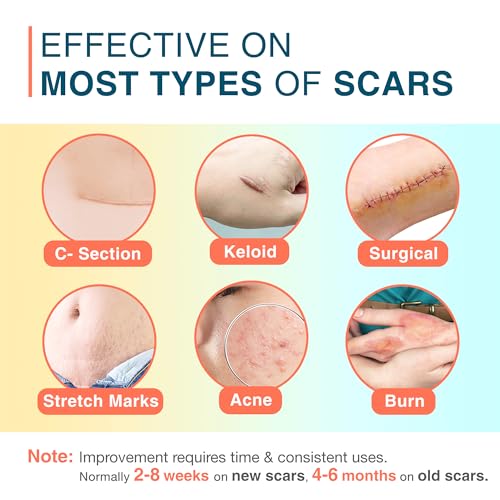 Silicone Scar Sheets, 1.55¡± x 78¡± - 2M Roll, Reusable Silicone Scar Tape, Medical Scar Strips for C-Section, Keloid Bump, Stretch Marks, Burn, Acne, Tummy Tuck, Surgical Scar Removal