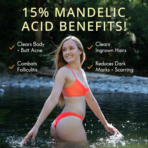 Almond Clear Level 2 Serum | Mandelic Acid Body Serum for Acne, Folliculitis, Aging Skin, Ingrown Hairs, Dark Spots on Face, Chest, Butt, Back, Thighs, Arms | 4 oz