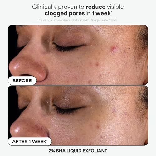 Paula's Choice Complexion Clarity Kit, 3 Piece Set Includes Full-Sized 2% BHA Exfoliant, 1% Retinol Treatment, Full-Sized 10% Azelaic Acid Booster, Skin Care Set for Clear, Glowing Skin