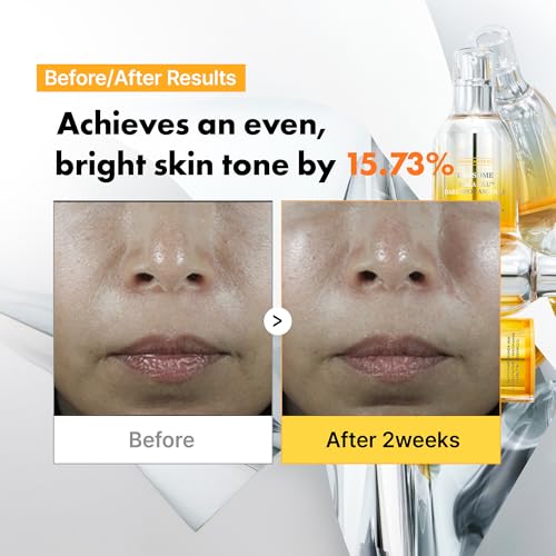 APOTHE Exosome Mela-Glu Dark Spot Ampoule ? Brightening Serum with Grape Exosomes, Niacinamide & Arbutin, 1 fl oz (30ml)