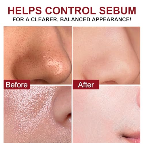 Black Rice Exfoliant and White Rice Ampoule Exfoliant, Peel Shot Glow Exfoliating Face Serum, Korean Skin Care Soft Exfoliating Body Scrub Dead Skin Cells, Blackheads Remover For All Skin Types 100ml