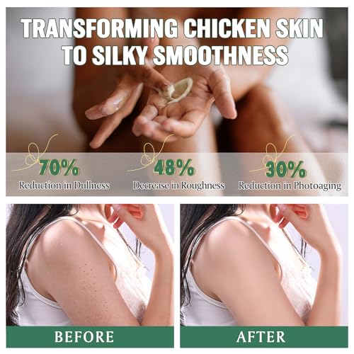 Beef Tallow For Skin ? Natural Whipped Tallow and Honey Balm Face Moisturizer, Organic Grass-Fed Tallow, Deeply Nourishing Skin Balm for Face & Body, Moisturizing Cream for Dry Skin