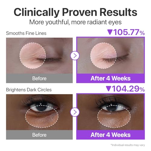 numbuzin No.9 NAD+ Retinol Eye Cream, Depuffing & Firming Eye Serum for Dark Circles, Wrinkles & Fine Lines, Peptides & Niacinamide for Glow & Undereye Radiance, Stocking Stuffers 0.33 fl oz