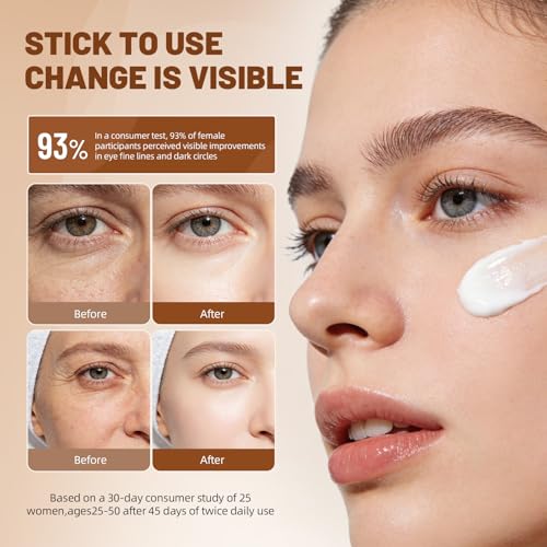 Korean Eye Cream for Dark Circles & Puffiness, 1.06oz Hydrating Under Eye Moisturizer for Fine Lines, Firming, Brightening & Smooth Skin ? Lightweight, Gentle Daily Anti-Aging Eye Treatment