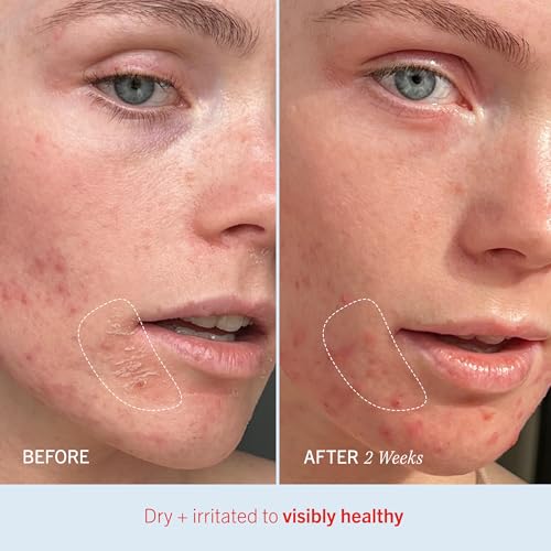 First Aid Beauty - Ultra Repair Cream, Intense Hydration Whipped Colloidal Oatmeal, Clinically Proven to Strengthen Skin Barrier in 7 Days & Helps Relieve Eczema, Luxury Face & Body Moisturizer, 6 oz