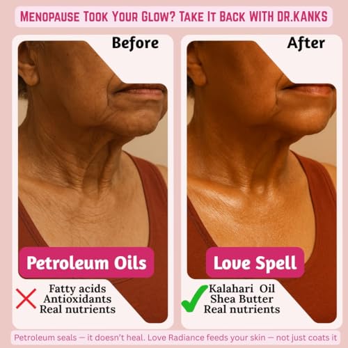 Dr. Kanks LoveSpell Body Oil ? Plant-Based Moisturizing Oil for Dry & Ashy Skin, 24-Hour Glow & Hydration, Non-Greasy Finish, Luxury Long-Lasting Scent. 8 oz
