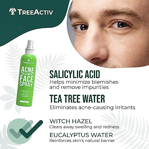 Acne Face Spray, 4 fl oz Facial Spray with Witch Hazel, Salicylic Acid for Acne Prone and Oily Skin, for Hormonal, Severe Cystic Acne, Skin Clearing Toner, 1000 Sprays