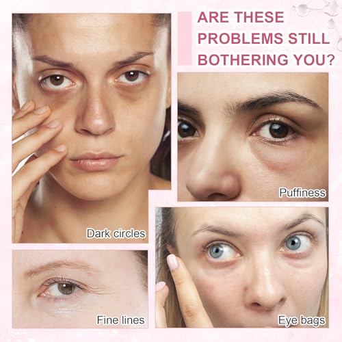 5% Caffeine Eye Serum Treatment,Hyaluronic Acid & Niacinamide, Under Eye Cream for Dark Circles, Anti Aging 360¡Æ Massage Rollerball - Reduce Puffiness, Wrinkles & Fine Lines, 0.5 fl. oz
