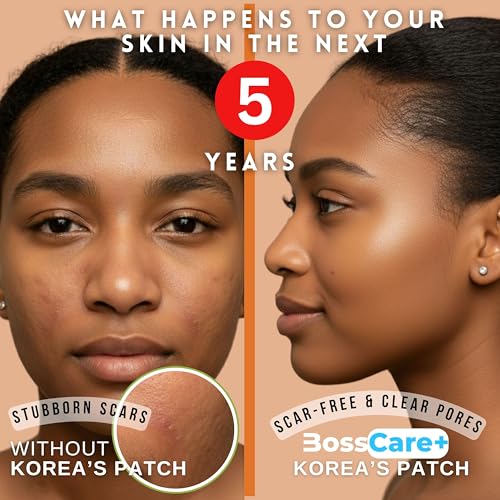 Original Korean Hydrocolloid Acne Pimple Patches, Spot Cover Stickers Absorb Pus, Shrink Pimples & Whiteheads, Scar-Guard Formula (K-Perfect Everyday Thin Pack, 56 Count, 3S)