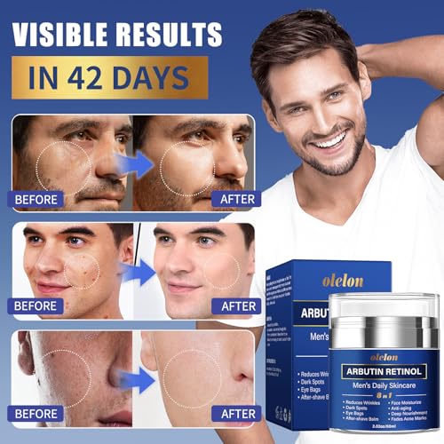 8-in-1 Face Cream for Men, mens face moisturizer with Alpha Arbutin, Retinol, Collagen and Hyaluronic Acid, Anti-Aging Face Cream for Men, Eye Bags Treatment & Wrinkle Cream 2.03oz
