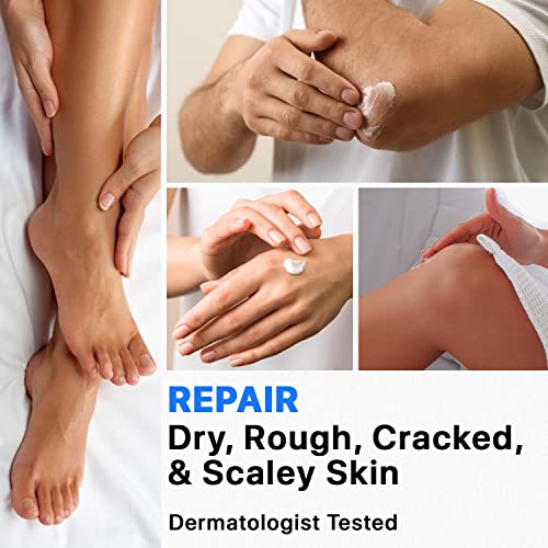 Ebanel Bundle of 40% Urea Cream and Callus Remover Gel