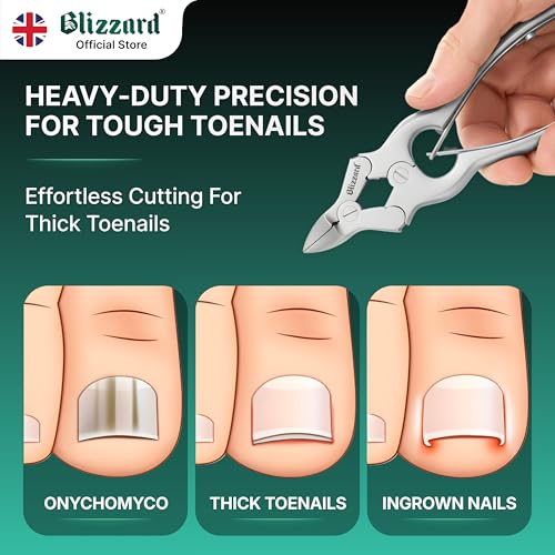 Toenail Clippers by Blizzard ? Medical Grade Double Action Toe Nail Nipper Cutter for Thick Nails Seniors ? 6 inch German Tool Double Spring