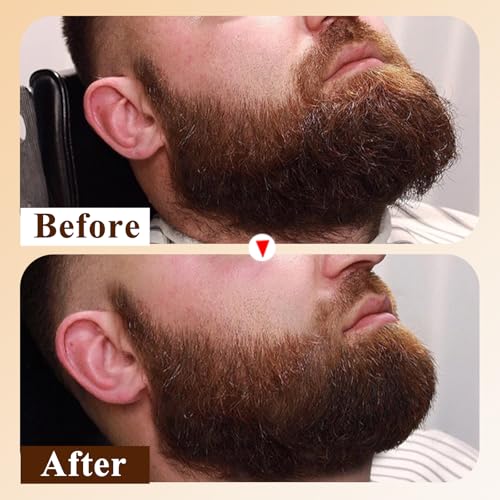 Mens Beard Oil Capsules,Natural Beard Oil for Men,Naturally Ingredients with Argan Oil,Grapeseed Oil,Jojoba Oil and Vitamin E for Softening and Moisturizing Beard (Cedarwood)