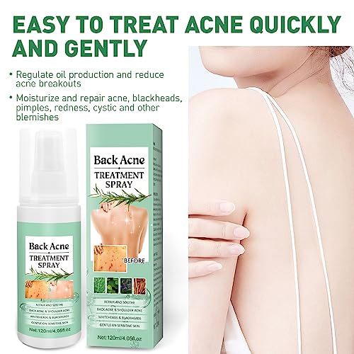 Back Acne Treatment With Herbal Formula, 2% Salicylic Acid & Tea Tree Oil - Body Spray Solution for Acne, 120ml (2PCS)