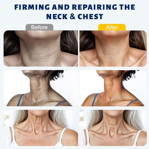 Neck Firming Cream with Roller, Anti-Aging, Smooths Neck Wrinkles, Improves Crepey Skin, Lifts & Firms Neck Skin, Tightening & Hydrating, Collagen, Multi Peptide, Hyaluronic Acid, 2 Pack