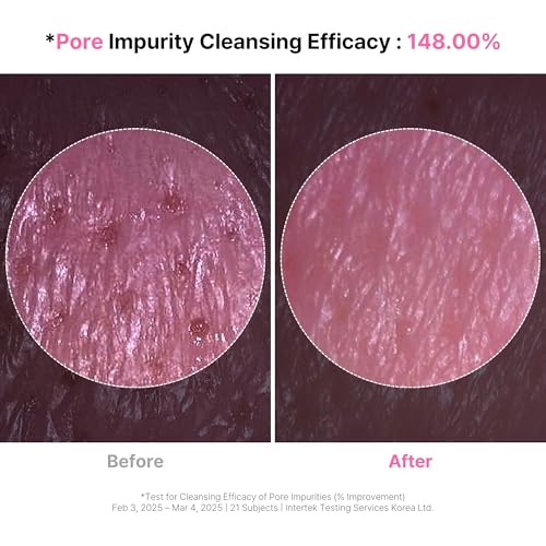 4-in-1 Konjac Jelly Face Cleanser ? Gentle Daily Exfoliating, Deep Cleansing, Pore Care & Makeup Removal | Berry Smoothie Texture with Raspberry & Vitamin B+C+E Complex | Dermatologist-Tested