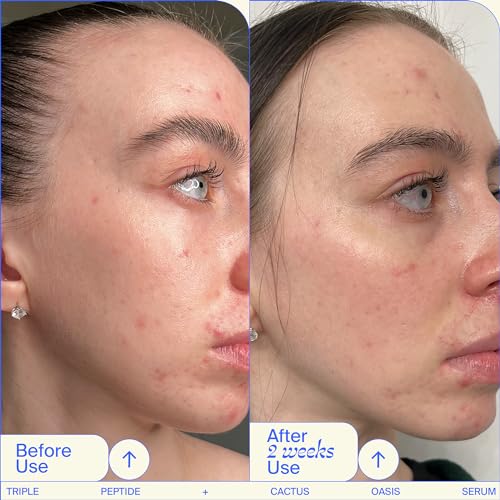 Youth To The People Triple Peptide + Oasis Face Serum - Hydrating + Firming Serum for Dry Skin, Plumps Fine Lines with 4 Types of Hyaluronic Acid, Peptides, Preps for Makeup, Fragrance-free - 1 fl oz