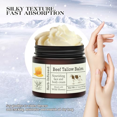 After Sun Lotion with Aloe Vera - Ultra Cooling Aloe Vera for Sunburn Hydration with Cocoa Butter & Rosehip Oil - Hydrating Aloe Lotion After Sun Moisturizer for Dry Skin with Hyaluronic Acid