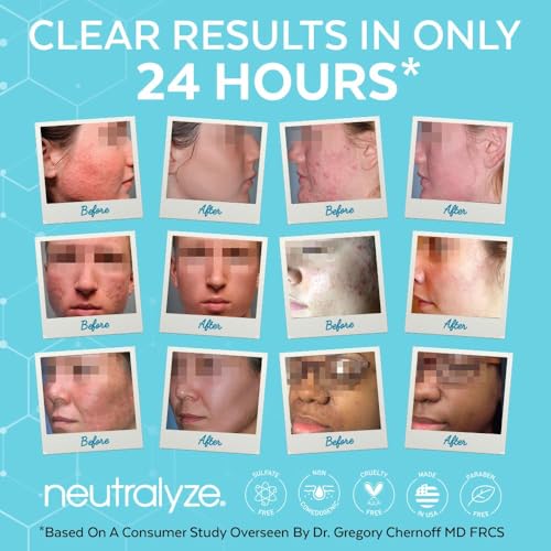 Neutralyze Renewal Complex Acne Moisturizer for Face - Maximum Strength, Time Released 2% Mandelic Acid & 2% Salicylic Acid Acne Treatment Cream - Suitable for All Skin Types, Teens & Adults
