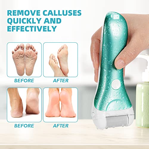 Callus Remover for Feet, Nicebirdie Electric Foot File Callus Removers Rechargeable Waterproof Pedicure Tools Foot Scrubber Shaver Feet Care Tool for Cracked Heels Dead Skin £¨Blue+Golden £©