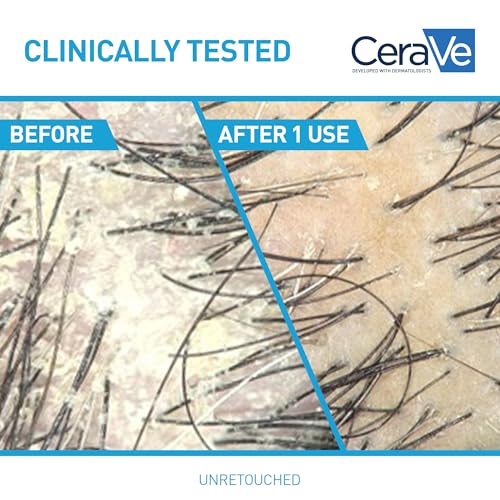 CeraVe Hydrating Anti Dandruff Shampoo, 1% Pyrithione Zinc Dandruff Treatment With Ceramides, Niacinamide & Hyaluronic Acid, Helps Eliminate Flakes & Provides Itchy Scalp Relief, Sulfate Free, 12 Oz