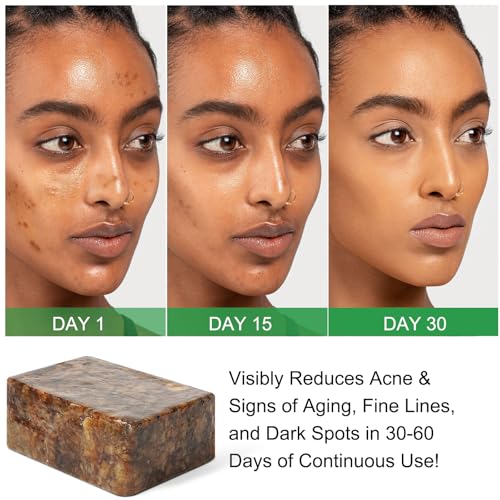 Pure Tallow Soap Bar ? Unscented, Oatmeal and Activated Charcoal, Fragrance Free ? Dr. Seymour's Simple Soap - Moisturizing Face & Body Wash for Sensitive, Dry, Itchy Skin ? Handmade in USA
