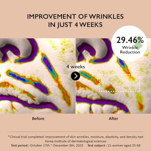 HARUHARU wonder Centella Phyto & 5 Peptide Concentrate Cream, Daily & Night Cream, Nourishing, Wrinkles improvement for all skin types, Vegan, Cruelty-Free, Korean Skincare, 1.01 fl. Oz
