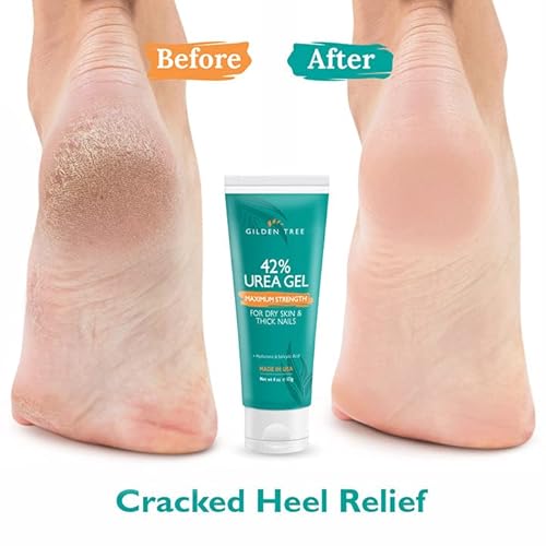 Max Strength 42% Urea Gel + Organic Shea Butter Cream Bundle