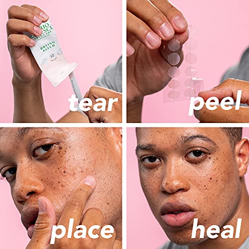 Mario Badescu Drying Patch Blemish Covering, Invisible Spot Treatment, Absorbing All Day Polymer Adhesion with Vitamin C, Vegan & Cruelty Free, Strong Hold (60 Patches, 12mm), Clear