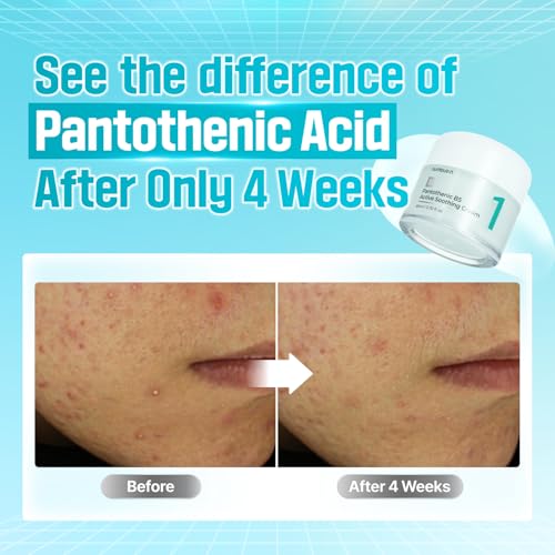 numbuzin No.1 Pantothenic B5 Active Soothing Cream | Remove sebum and skin troubles, Pantothenic acid, Korean Skincare Gift for Women | 2.70 fl oz