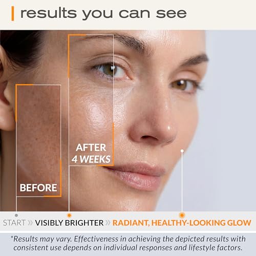 Ella & Eden Vitamin C Serum for Face - Hyaluronic Acid, Aloe Vera, Vitamin E, CoQ10 - Anti-aging, Skin Brightening - Paraben-Free, Fragrance-Free, Suitable for All Skin Types - 1 Fl Oz