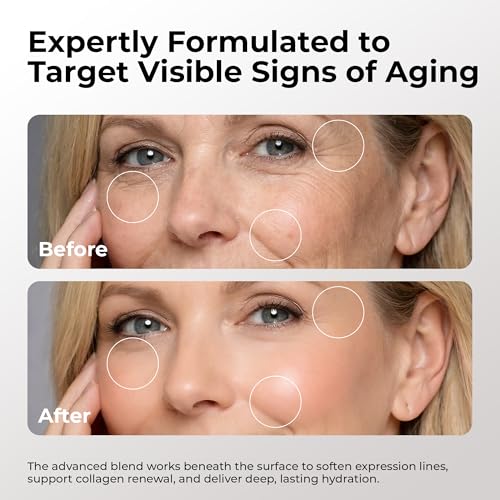 SKIN DEVA 20% Argireline Serum with Matrixyl 3000 Pure Hyaluronic Acid Serum For Face Deep Wrinkle Reducer Anti Aging Tones Skin and Stimulates Collagen Peptides Serum For Face