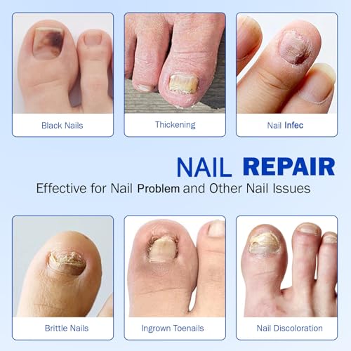 Nail Patches 42PCS, Overnight Toenail Treatment Extra Strength Repair Pads, Multi-Purpose for Thick, Cracked & Discoloured Nails, Long-Lasting 8-Hour Repair, Nail Care and Repair for Damaged Nails