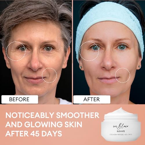 Elevate Moisturizing Cream for Face | Facial Care for Dry Skin with SPF | Hydrating Moisturizer Rich in Niacinamide, Hyaluronic Acid & Collagen Peptide | Anti Aging Day & Night Cream