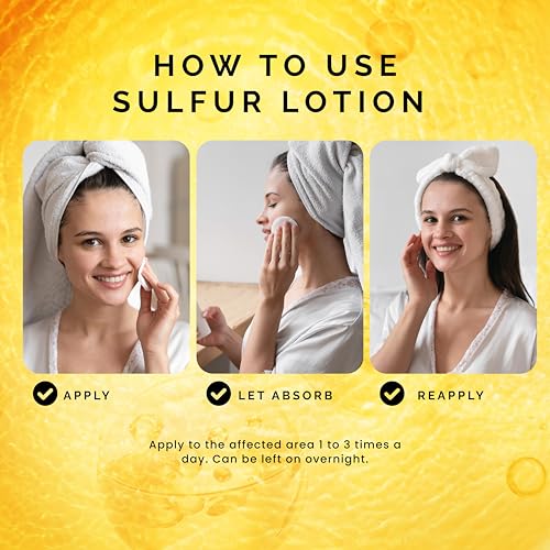 Pili Sulfur Lotion ? Helps Control Oily Skin & Reduce Shine ? Lightweight Face & Body Skincare ? Fast-Absorbing & Non-Greasy Formula ? 4.2 fl. oz.